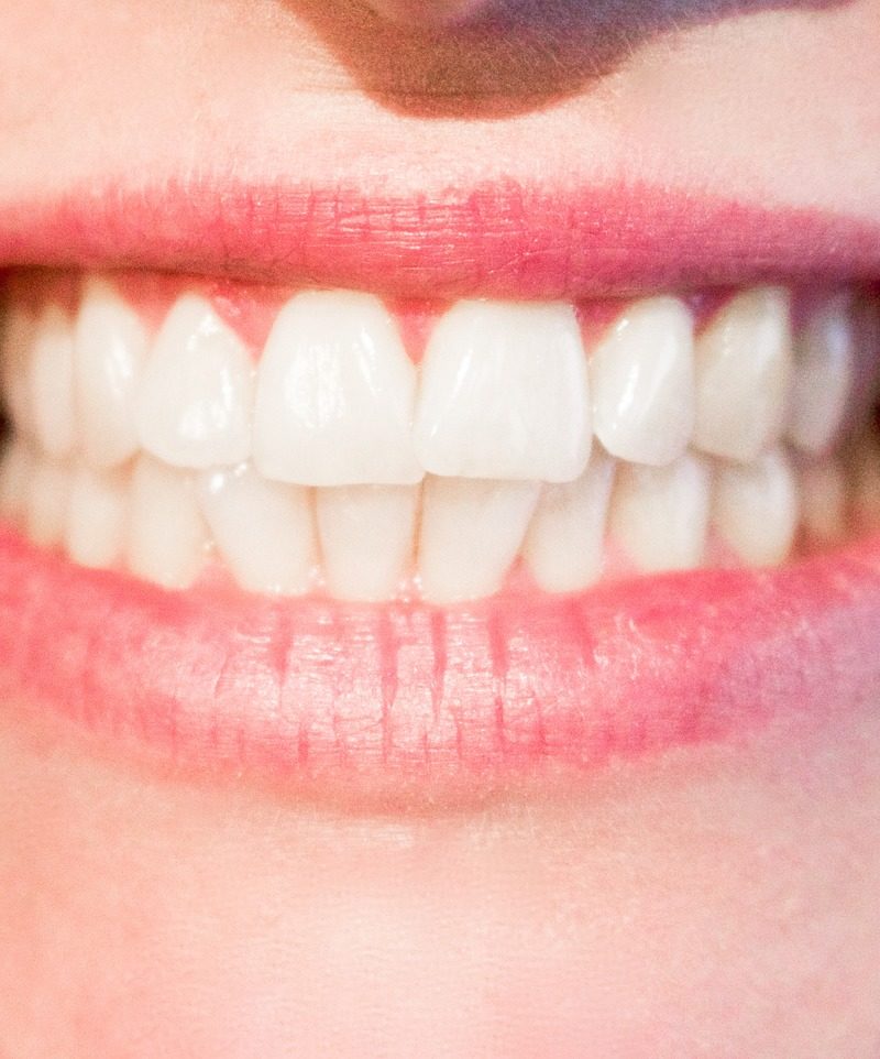 Obecna technika wykorzystywana w salonach stomatologii estetycznej może spowodować, że odzyskamy piękny uśmiech.